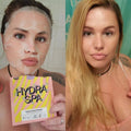 hydra spa hyaluronsyre ansigtsmaske